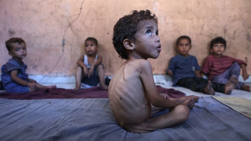 Malnutrition