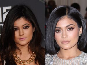 Urfi Javed's lip filler sparks controversy